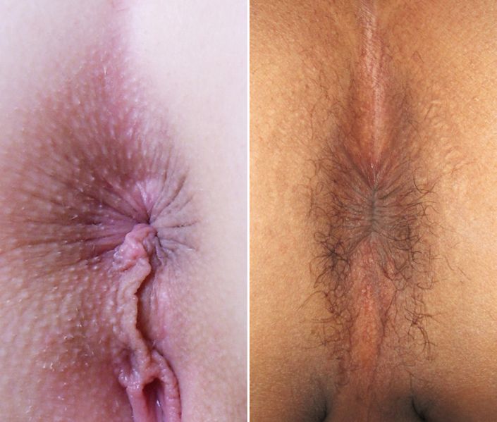 Fil:Female and male anus.jpg